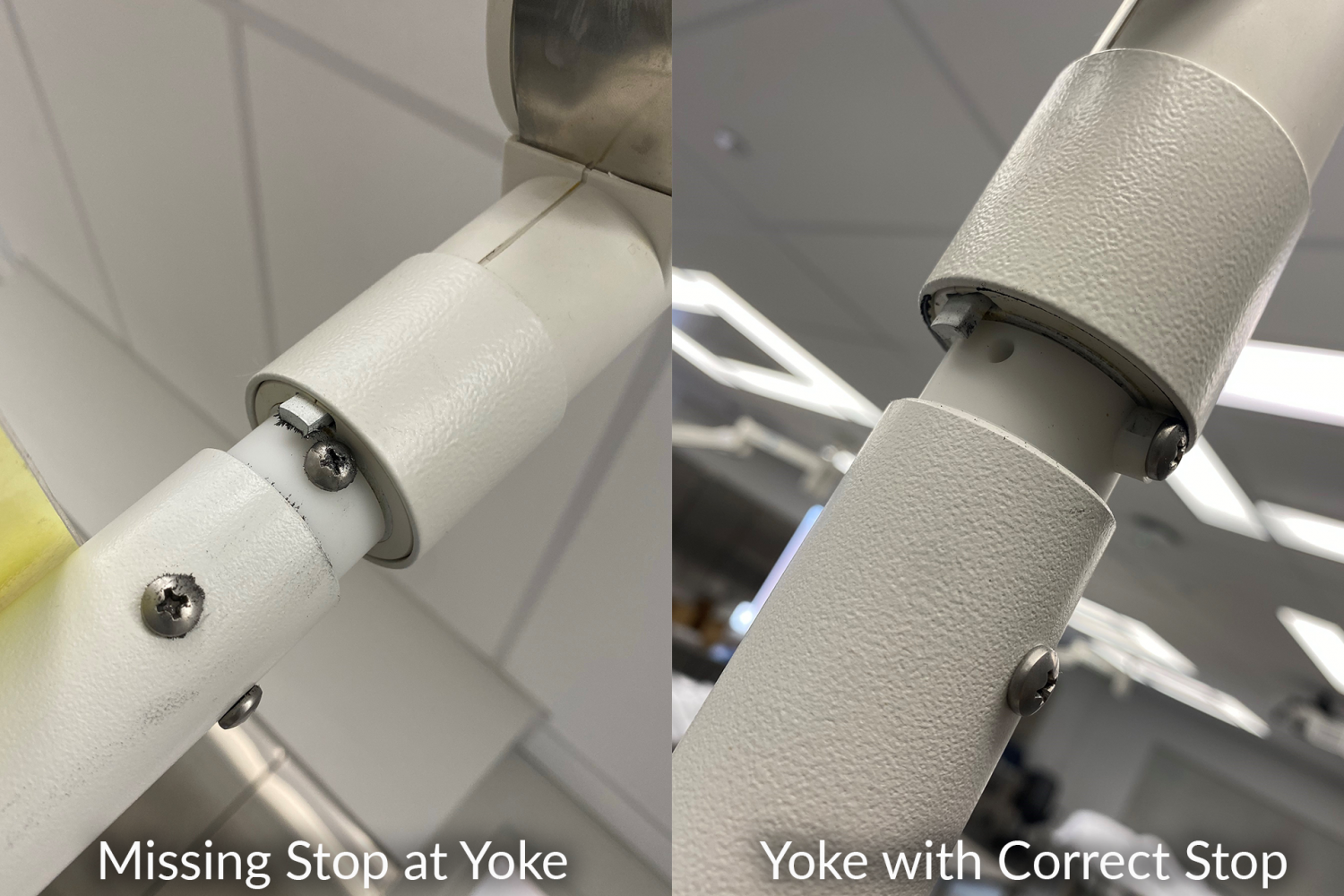 Yoke Stop Replacement at Thomas Jefferson University Hospital
