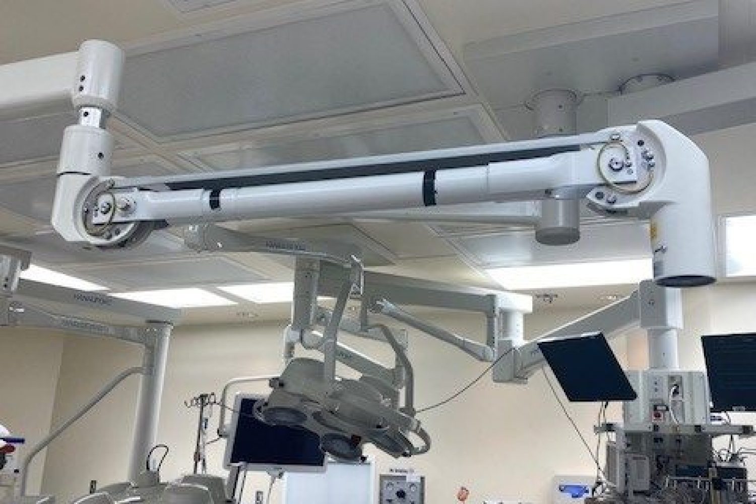 Spring Arm Replacement at Vanderbilt University Medical Center